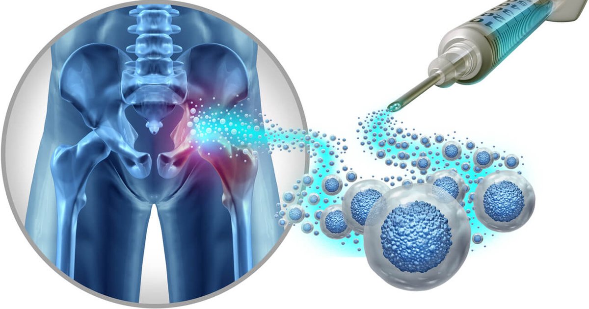 Recovery After Therapy