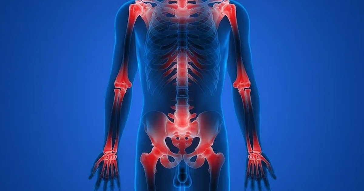 Preparation for DMG Test